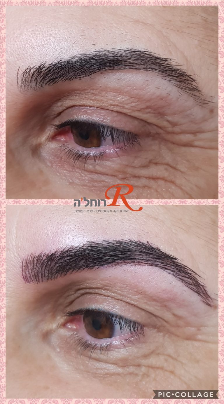 מיקרובליידינג - עיצוב גבות בשיטת השערה