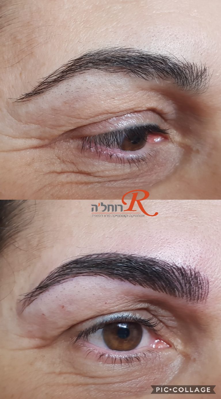 מיקרובליידינג גבות